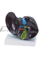 The model of liver and diseased gallbladder